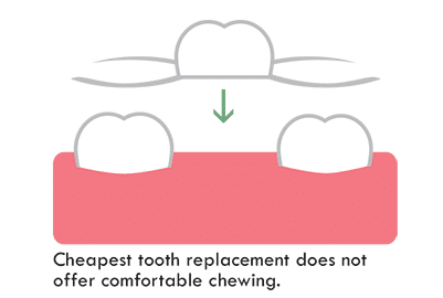 1738865501 partial denture
