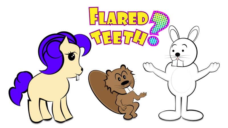 Flaring of the front teeth can occur in adults for various reasons.