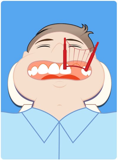 1738865936 dental bridges