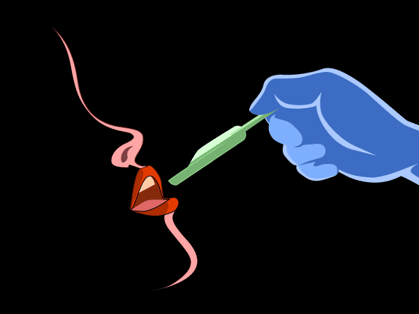 dental impressions