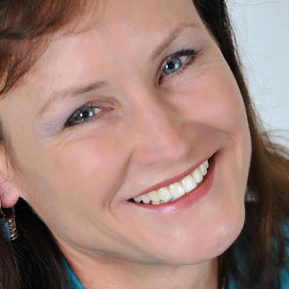 whiter teeth permanent